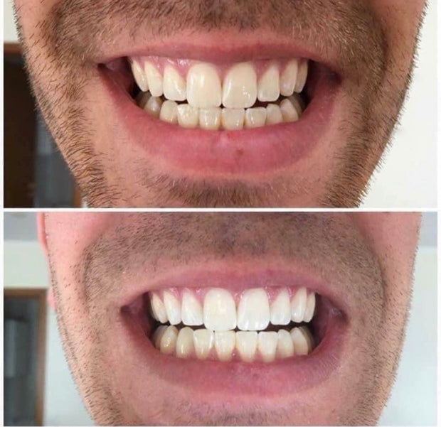 AP 24 Whitening Fluoride Toothpaste (8282271285541)