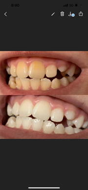 AP 24 Whitening Fluoride Toothpaste (8282271285541)