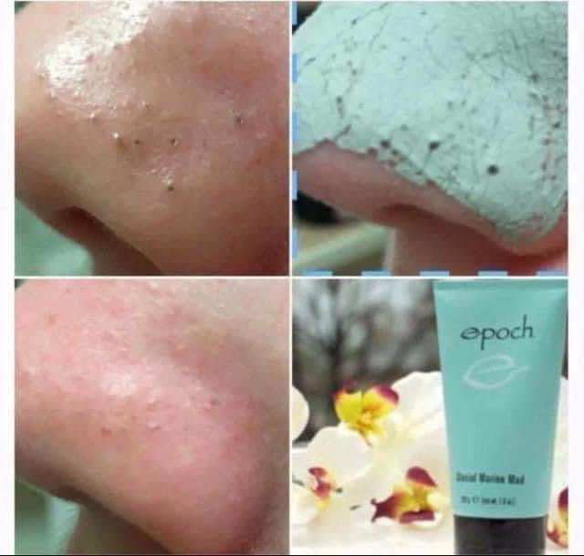 Epoch Glacial Marine Mud Mask – Really Roxie